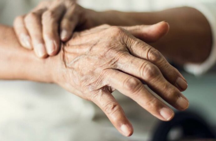 SUS inclui medicamento pioneiro para tratamento de demência relacionada ao Parkinson
