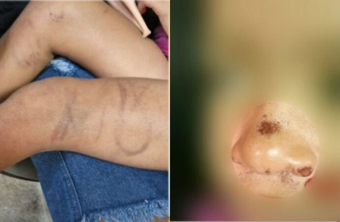 Mulher é presa suspeita de agredir a própria filha de cinco anos, em João Pessoa