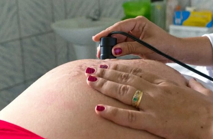Bolsa Família diminui risco de morte materna e infantil em até 31%
