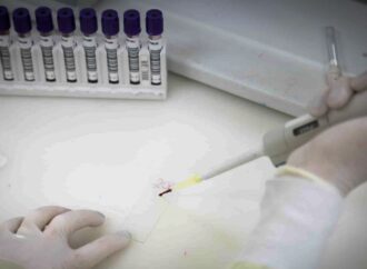 Exames descartam ebola em imigrante da República Democrática do Congo