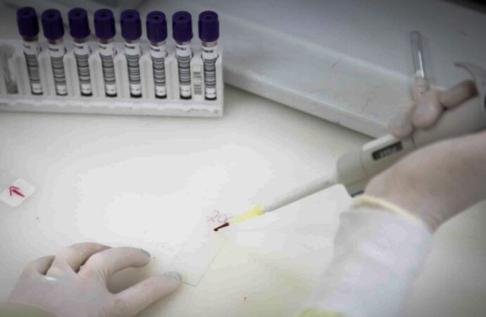 Exames descartam ebola em imigrante da República Democrática do Congo