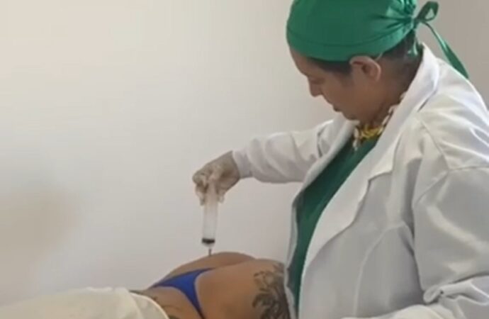 Falsa médica é presa, suspeita de aplicar silicone de construção em harmonização de glúteos